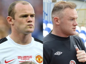 Rooney transplant